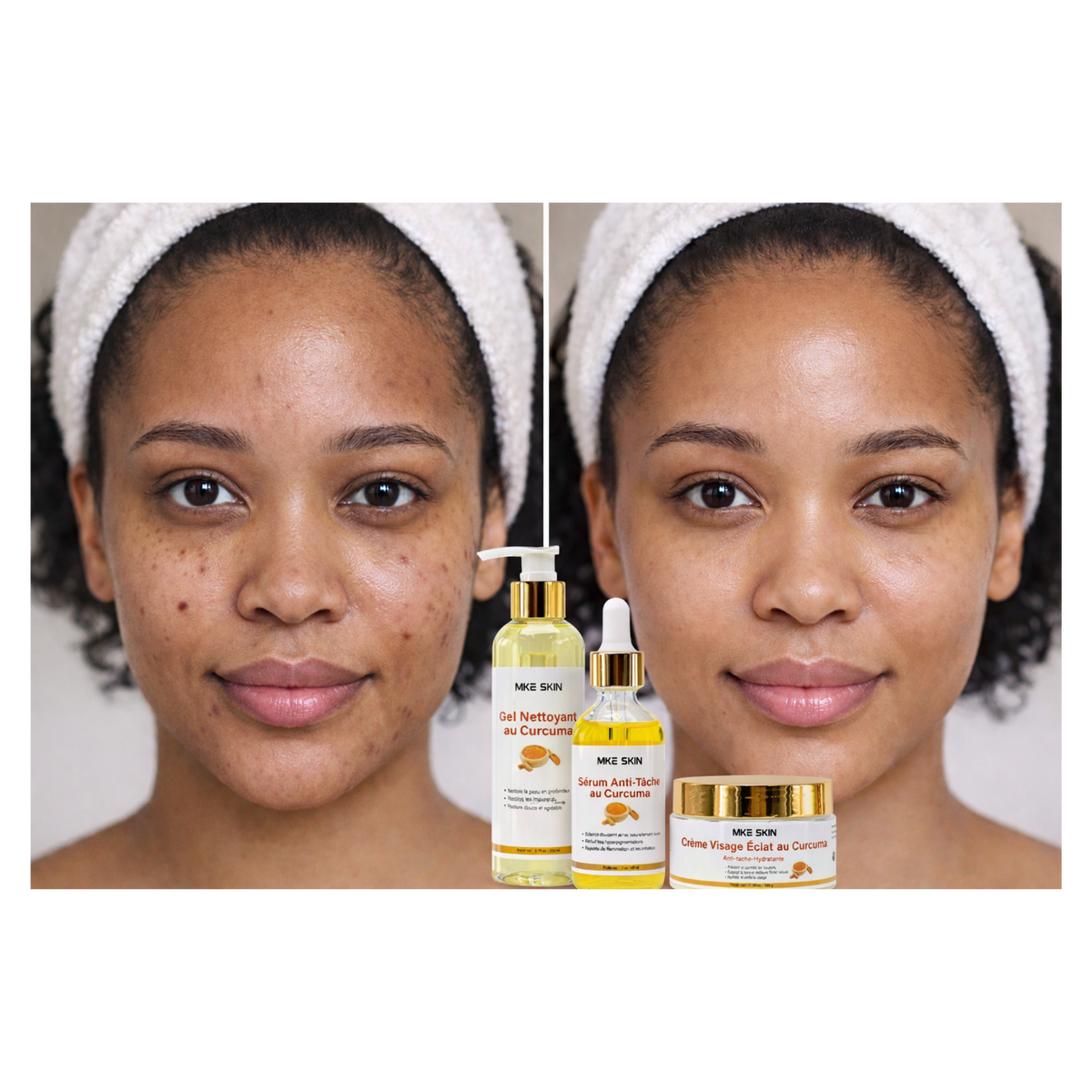 Routine Visage Éclat au Curcuma – MKE SKIN